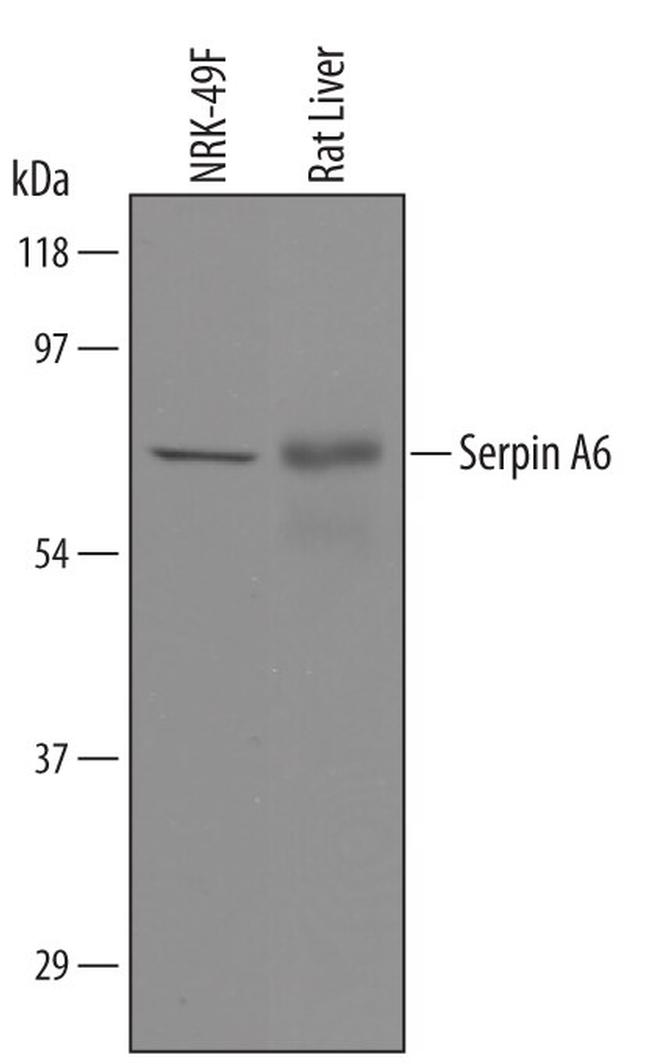 SERPINA6 Antibody in Western Blot (WB)