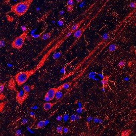 N-WASP Antibody in Immunohistochemistry (Frozen) (IHC (F))