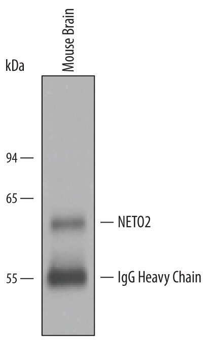 NETO2 Antibody in Immunoprecipitation (IP)