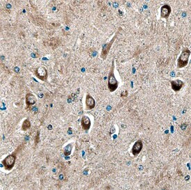 STX8 Antibody in Immunohistochemistry (Paraffin) (IHC (P))