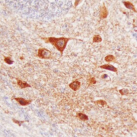 VWC2 Antibody in Immunohistochemistry (Paraffin) (IHC (P))