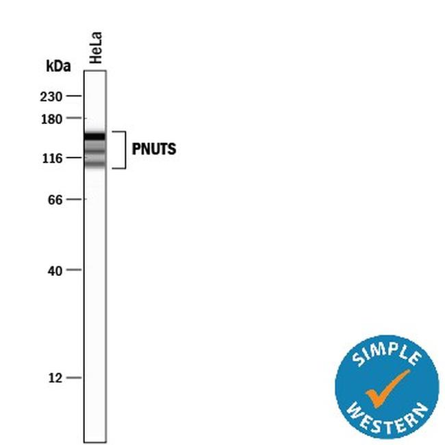 PPP1R10 Antibody in Western Blot (WB)