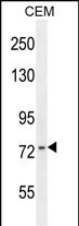 ZNF493 Antibody in Western Blot (WB)