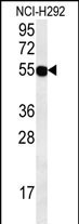ZNF492 Antibody in Western Blot (WB)