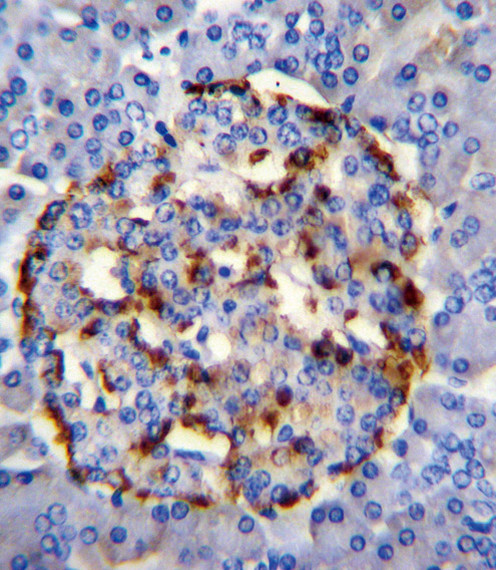 PLA2G2D Antibody in Immunohistochemistry (Paraffin) (IHC (P))