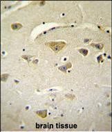 VSTM2A Antibody in Immunohistochemistry (Paraffin) (IHC (P))