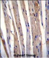 KRT73 Antibody in Immunohistochemistry (Paraffin) (IHC (P))