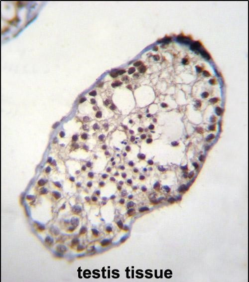 TSGA10IP Antibody in Immunohistochemistry (Paraffin) (IHC (P))