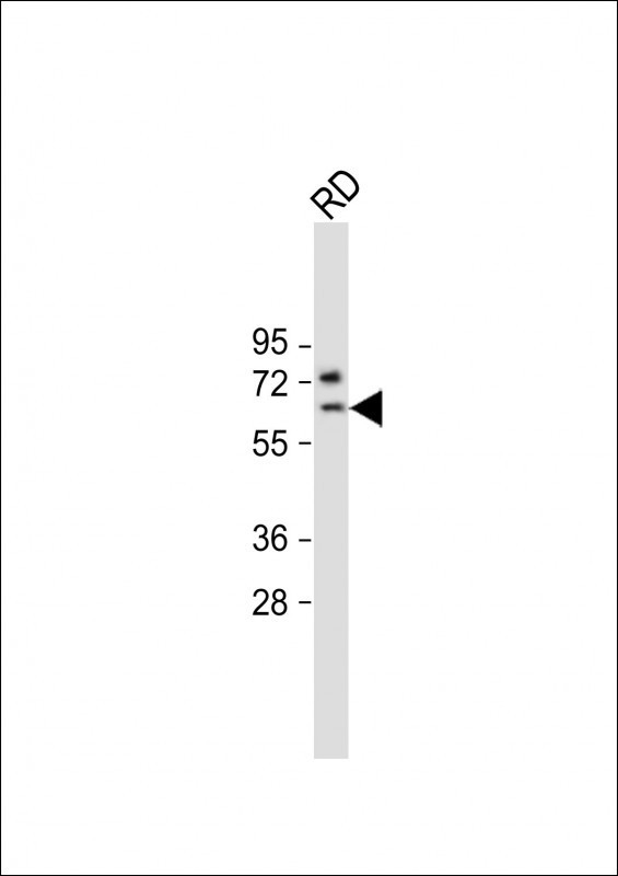 SMTNL1 Antibody in Western Blot (WB)