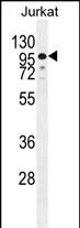 ZNF841 Antibody in Western Blot (WB)
