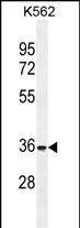 FOXI3 Antibody in Western Blot (WB)