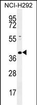 KCTD2 Antibody in Western Blot (WB)