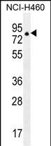 ZNF28 Antibody in Western Blot (WB)