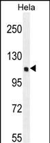 SIK3 Antibody in Western Blot (WB)
