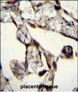SASH1 Antibody in Immunohistochemistry (Paraffin) (IHC (P))