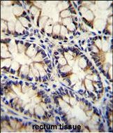 ECT2L Antibody in Immunohistochemistry (Paraffin) (IHC (P))