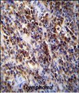 PARP9 Antibody in Immunohistochemistry (Paraffin) (IHC (P))