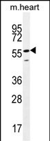 SMTNL2 Antibody in Western Blot (WB)