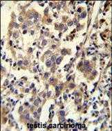 CCDC110 Antibody in Immunohistochemistry (Paraffin) (IHC (P))