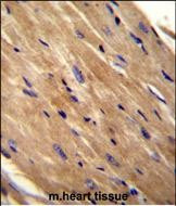 RhoJ Antibody in Immunohistochemistry (Paraffin) (IHC (P))