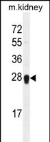 ARL5C Antibody in Western Blot (WB)