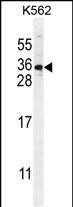 STARD6 Antibody in Western Blot (WB)
