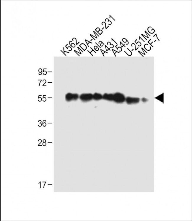 TUBB6 Antibody in Western Blot (WB)