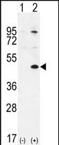 TGIF Antibody in Western Blot (WB)