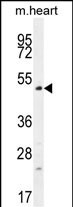 TSPYL4 Antibody in Western Blot (WB)
