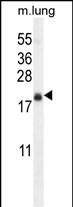 TMEM80 Antibody in Western Blot (WB)