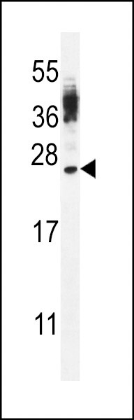 CT45A4 Antibody in Western Blot (WB)