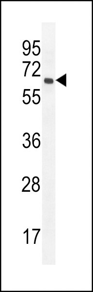 PRAMEF20 Antibody in Western Blot (WB)