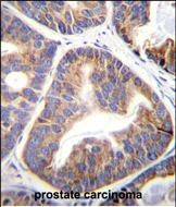 FAM109A Antibody in Immunohistochemistry (Paraffin) (IHC (P))