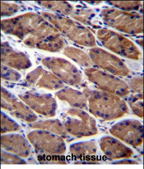 PODNL1 Antibody in Immunohistochemistry (Paraffin) (IHC (P))
