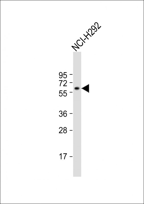 TBC1D3F Antibody in Western Blot (WB)