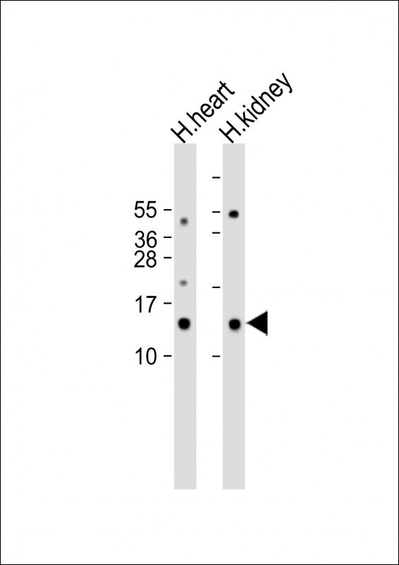 MT-ND3 Antibody in Western Blot (WB)
