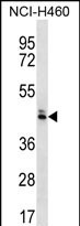 OR52N5 Antibody in Western Blot (WB)