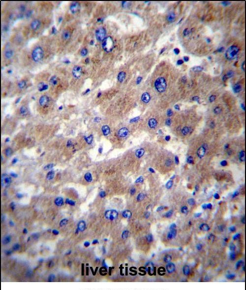 SLMO2 Antibody in Immunohistochemistry (Paraffin) (IHC (P))
