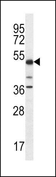 PSTPIP1 Antibody in Western Blot (WB)