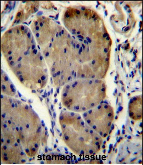 WDR86 Antibody in Immunohistochemistry (Paraffin) (IHC (P))