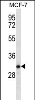 PRSS41 Antibody in Western Blot (WB)