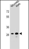 DHRS4L1 Antibody in Western Blot (WB)