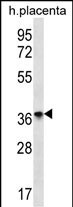 OR8D4 Antibody in Western Blot (WB)