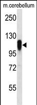 FBXO41 Antibody in Western Blot (WB)