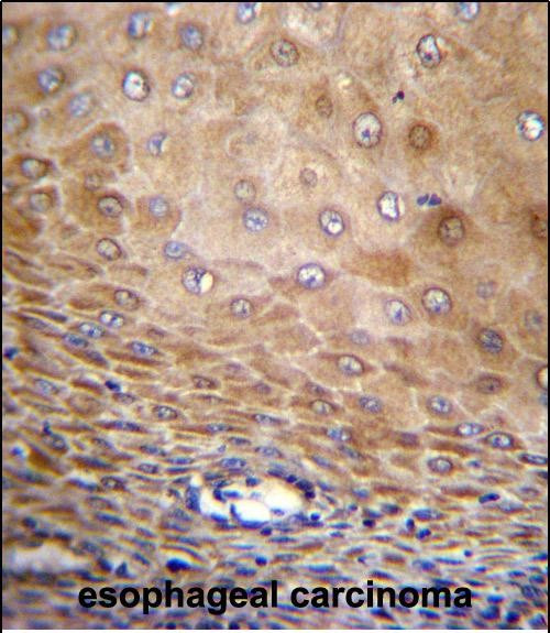 TMEM43 Antibody in Immunohistochemistry (Paraffin) (IHC (P))