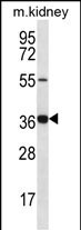 GRXCR1 Antibody in Western Blot (WB)