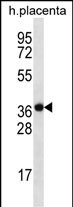 SLC38A8 Antibody in Western Blot (WB)