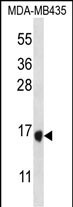 TAC4 Antibody in Western Blot (WB)