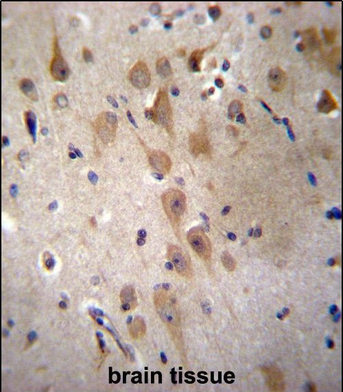GRIP2 Antibody in Immunohistochemistry (Paraffin) (IHC (P))