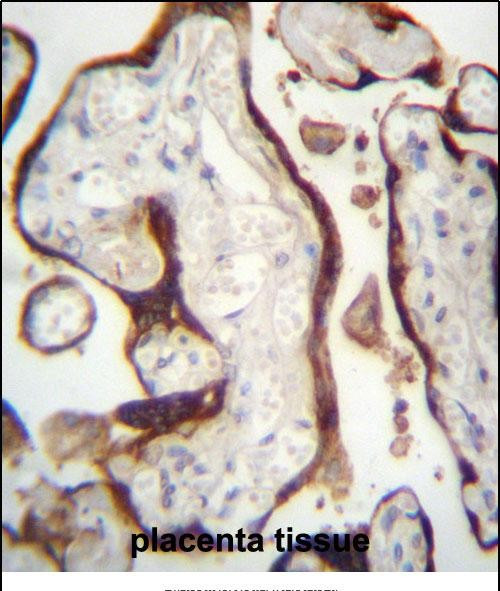 CSHL1 Antibody in Immunohistochemistry (Paraffin) (IHC (P))